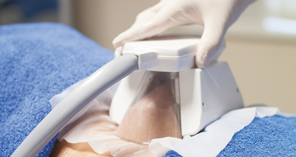 How Fat Freezing and HIFU Work Together? 2 Multiple Areas in One Session HIFU and Fat Freezing Banbury
