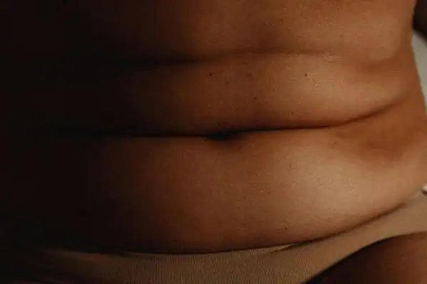 The Hidden Connection: How Stress Shapes Your Fitness and Body Composition 3 image of what stress can do on the stomach area and how Lipo 360 Banbury can help to change your body shape.