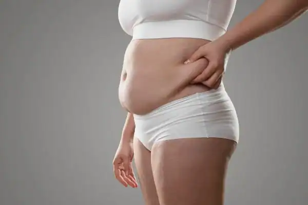 Image of stress belly Banbury How Lipo 360 can help manage your symptoms